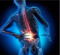 back pain