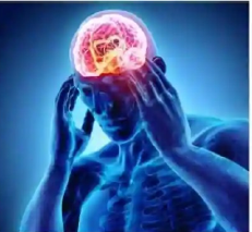 headache
