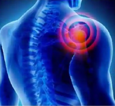 shoulder pain